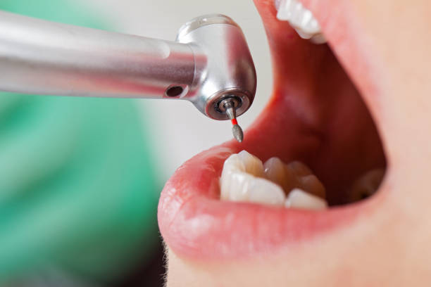 Best Walk-In Emergency Dental Services in Columbia City, IN